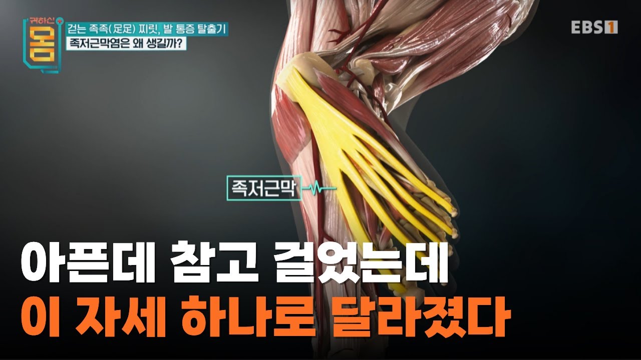 발바닥 통증의 진짜 해법 10초면 됩니다ㅣ아픈데 참고 있다면 이 스트레칭부터 해보세요ㅣ#귀하신몸