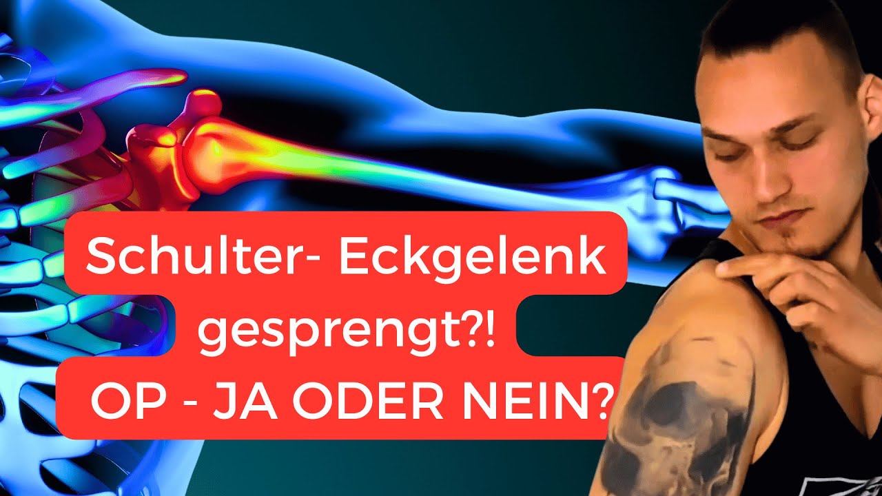 AC-Gelenksprengung Typ V: Meine Reha ohne OP (inkl. Handstand nach 6 Wochen!)