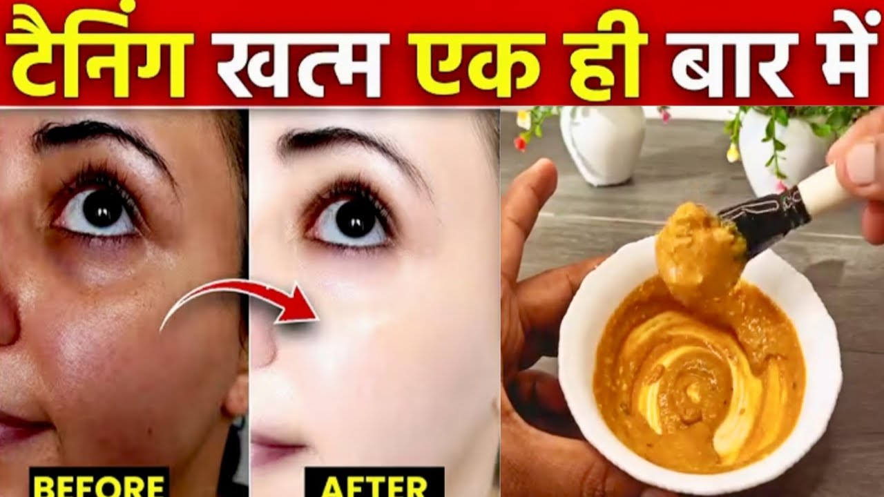 Tan Removal Home Remedies||How to Remove Tan at home|Face pack for glowing skin homemade#skincare