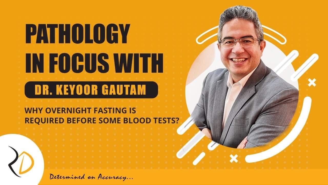 Episode 2 Why Overnight Fasting is required before some blood tests?