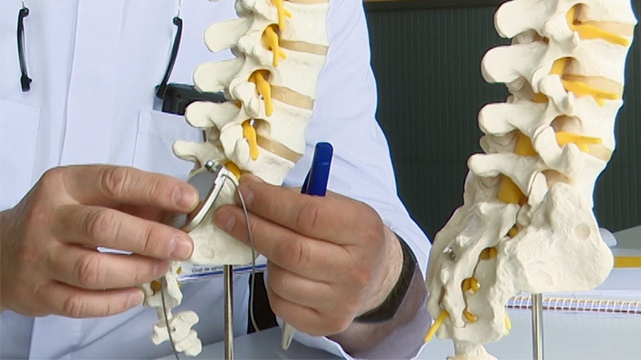 Neuromodulation: un pacemaker contre les douleurs chroniques