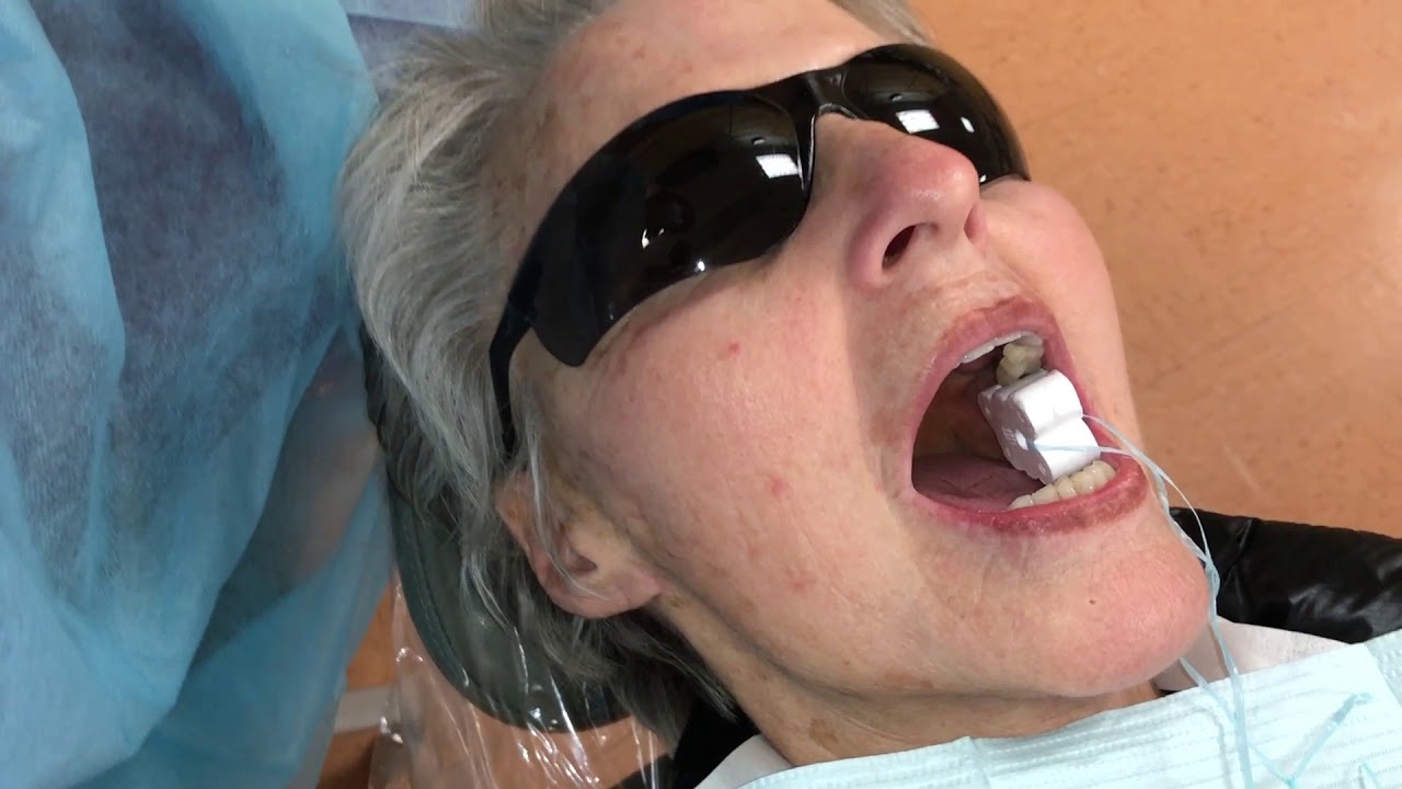 Gow Gates Nerve Block