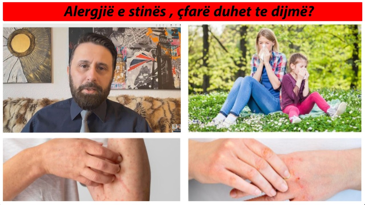 Jo poleni, ja SHKAKU i vërtetë i ALERGJISË / Si të zhdukni tështimat, kruarjet dhe hundën e bllokuar