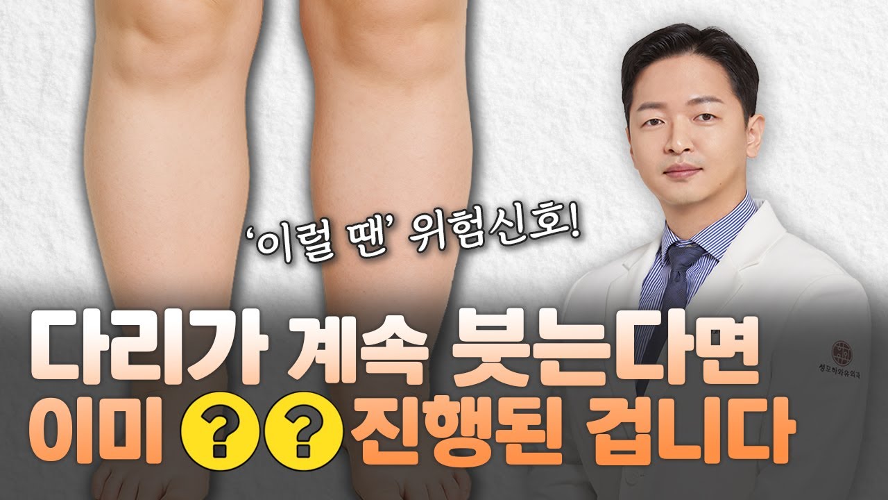 다리가 계속 붓는다면 OO가 진행된 겁니다