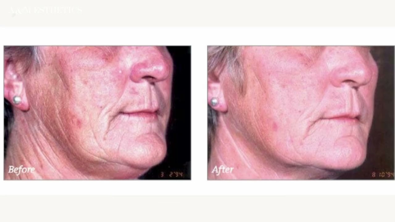 How to tell your skin care will work?