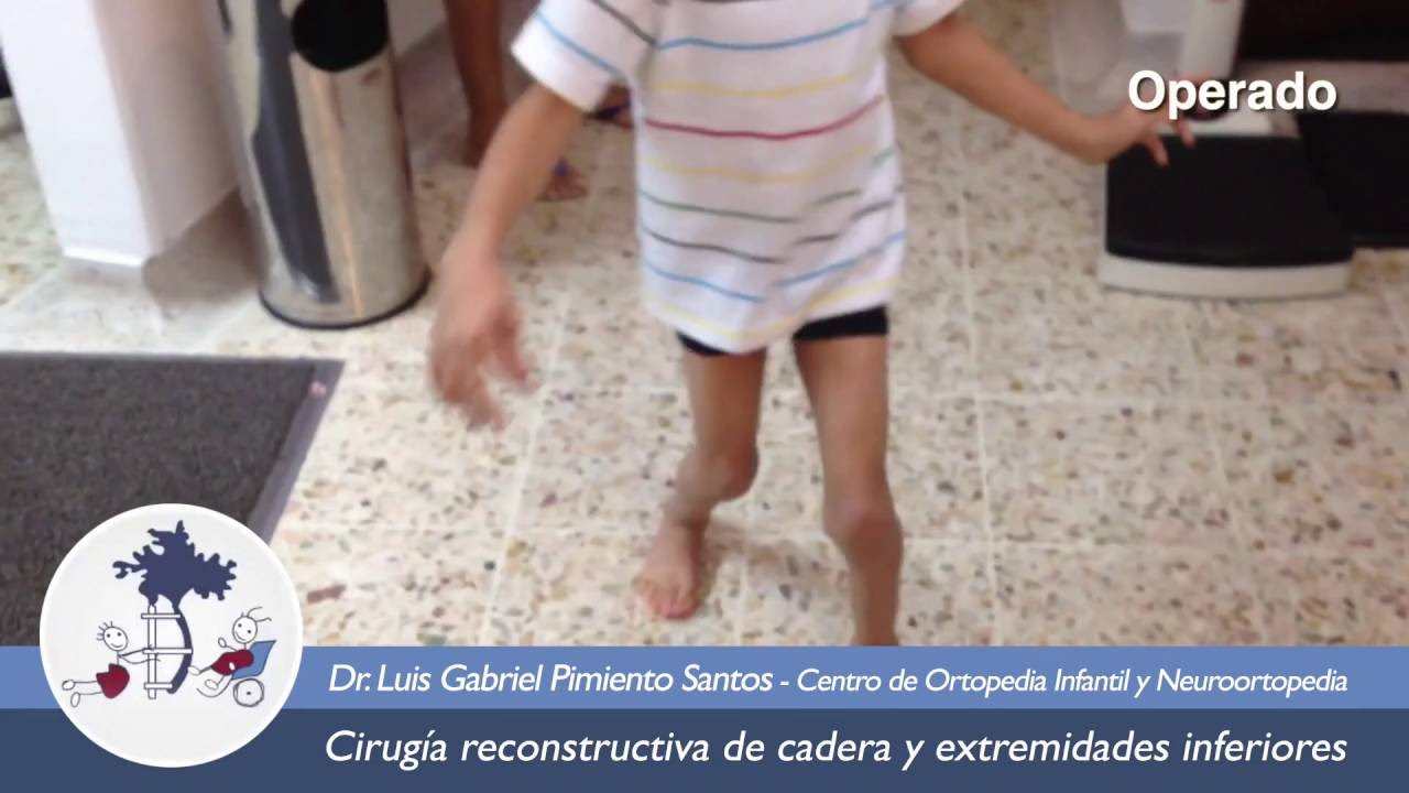 Parálisis Cerebral Infantil (Diplejia Espastica)