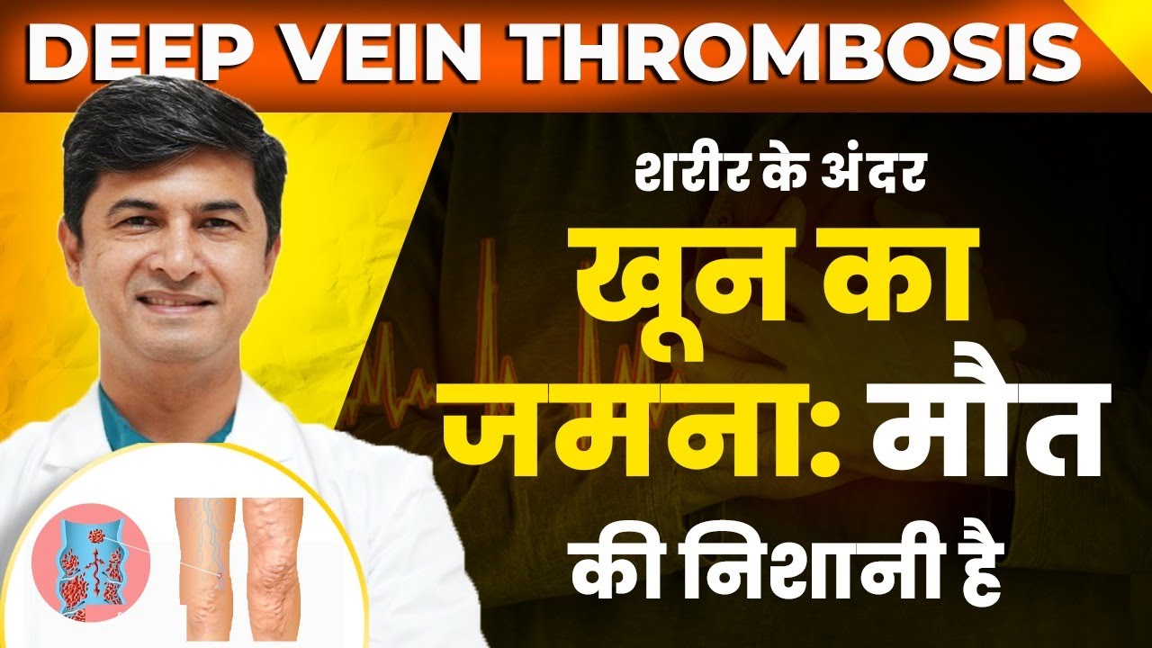 DVT से खून जमता है और फिर आता है Heart Attack l Dr Mahesh Wadhwani