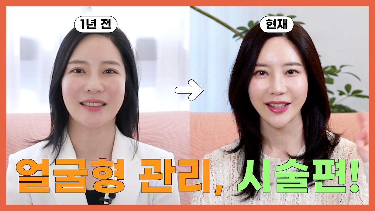 1년 만에 얼굴형이 확 바뀐 비결?! 리얼 비포애프터+리프팅 시술추천 총정리💆‍♀️