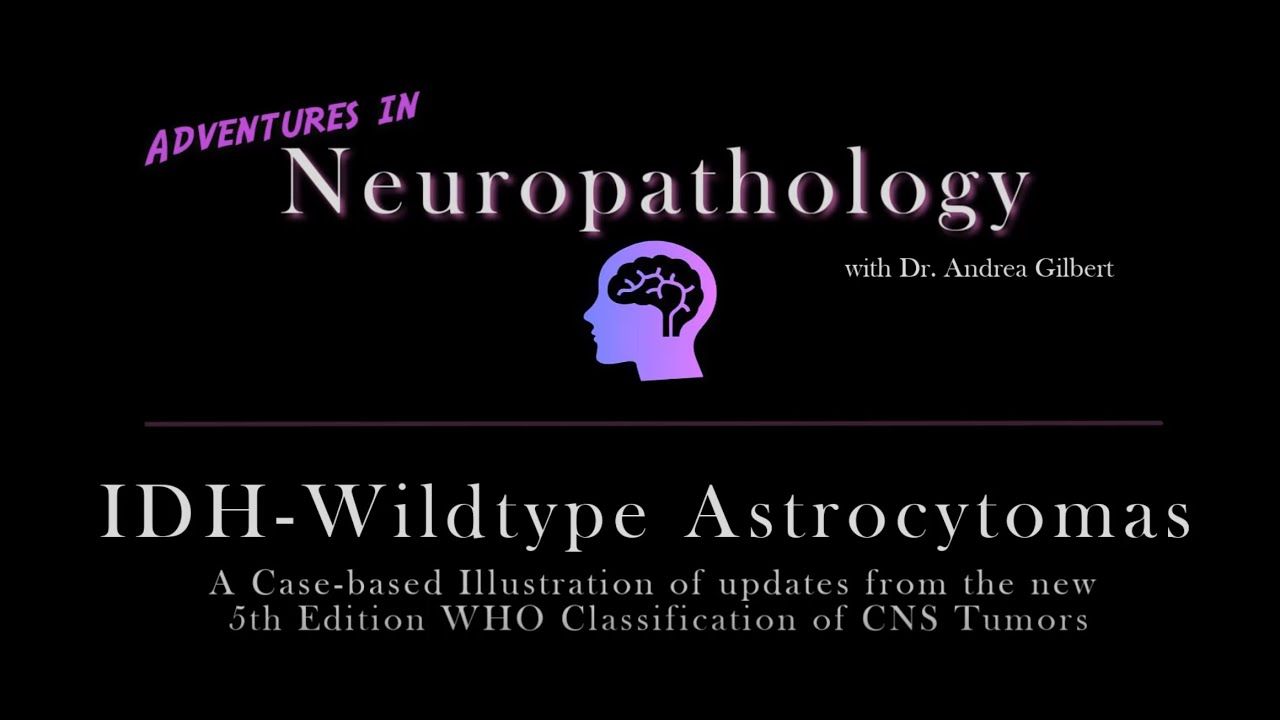 IDH - Wildtype Astrocytoma:  Update from the 5th Edition WHO Classification of CNS Tumors