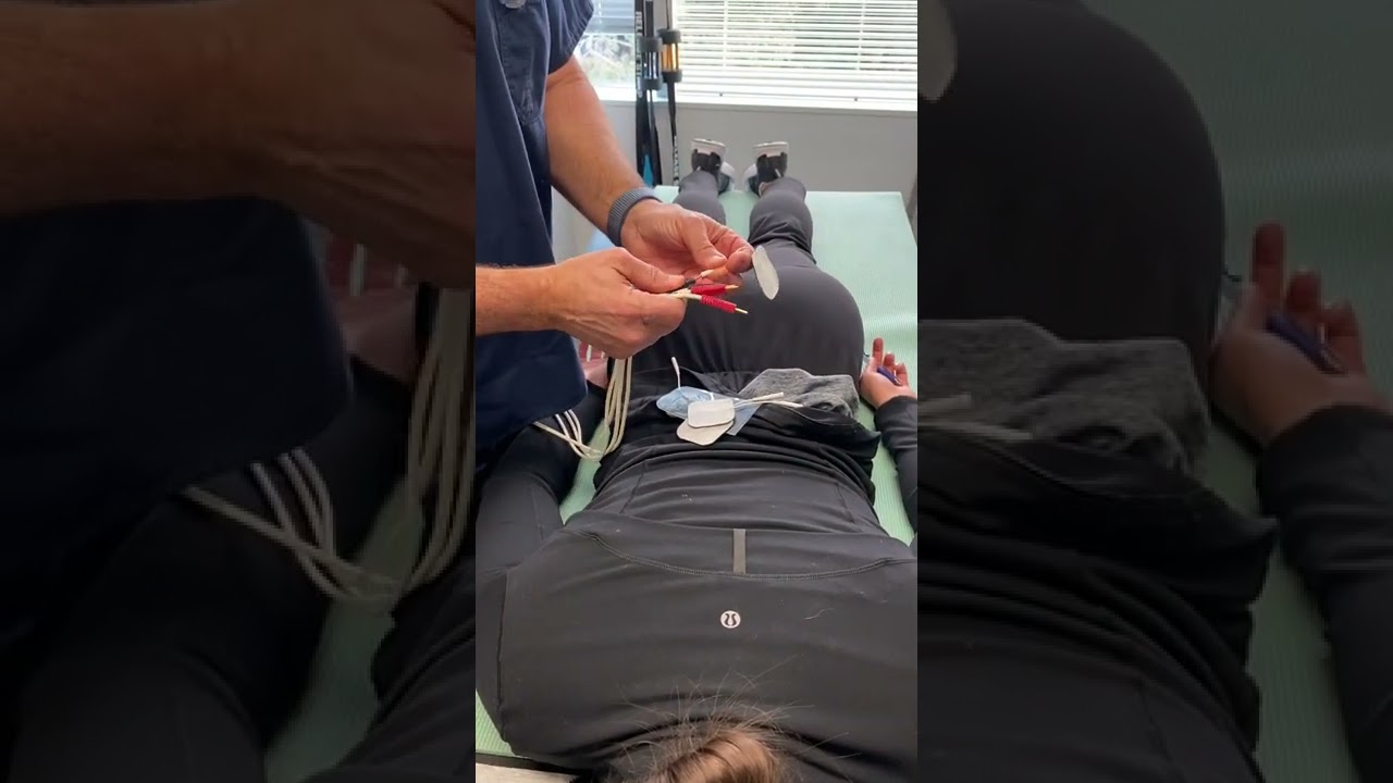 How to use interferential electro therapy equipment. How to setup electro stim. Low back tens setup