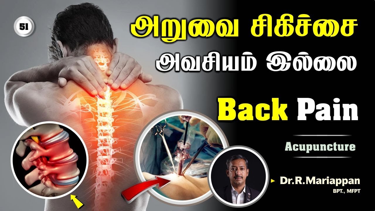முதுகு வலிக்கு அறுவை சிகிச்சை அவசியம் இல்லை  