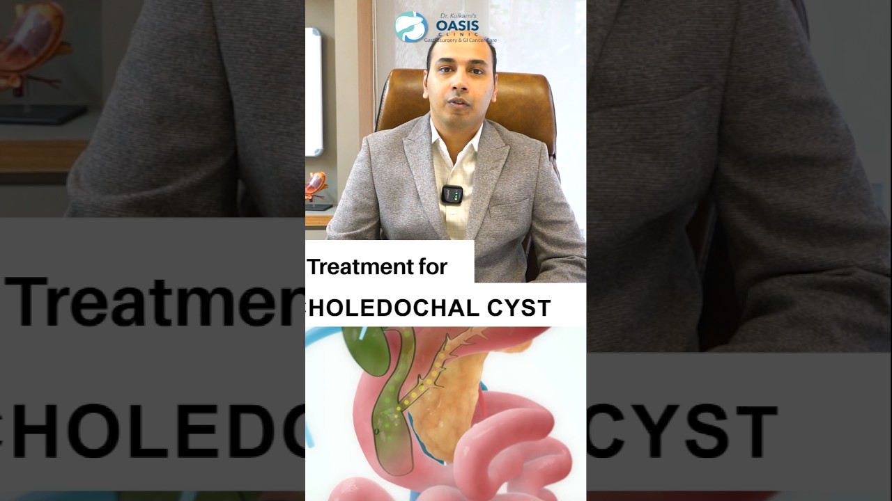 Bile duct Cyst treatment options! | Dr Aditya Kulkarni 
