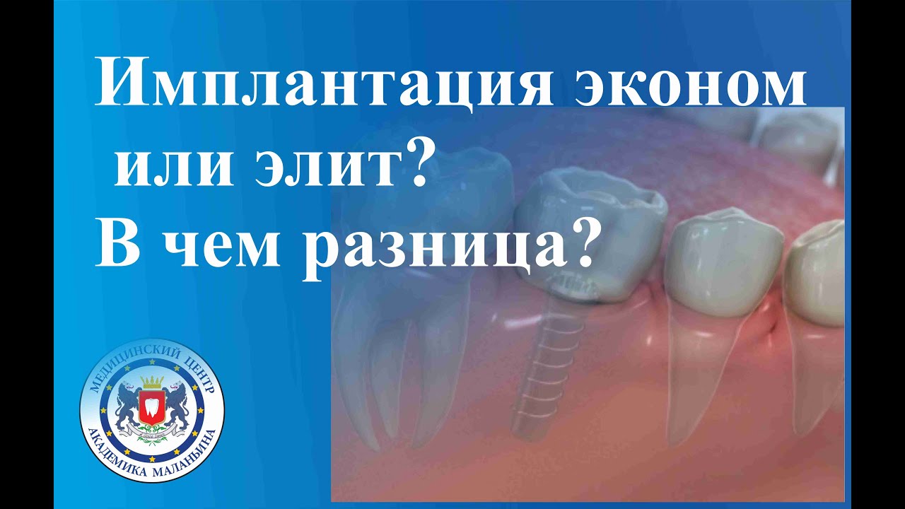Имплантация эконом или элит? В чем разница?