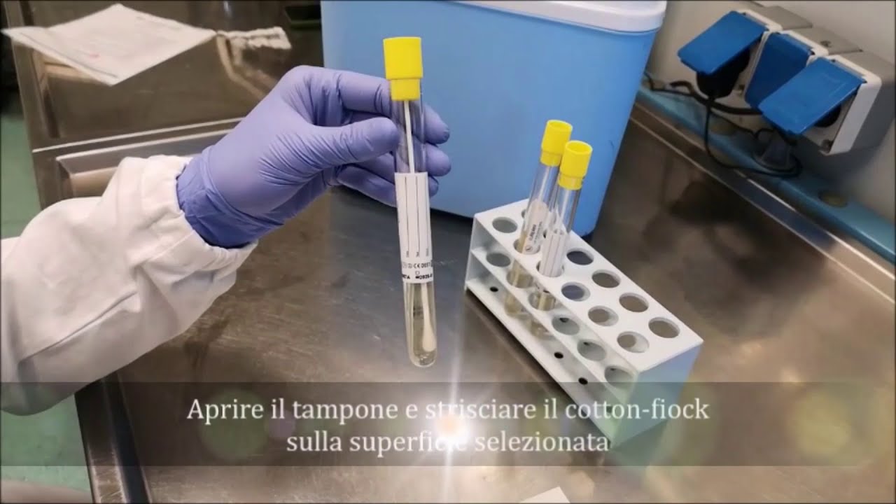 Procedure: come si esegue il campionamento delle superfici con tampone?