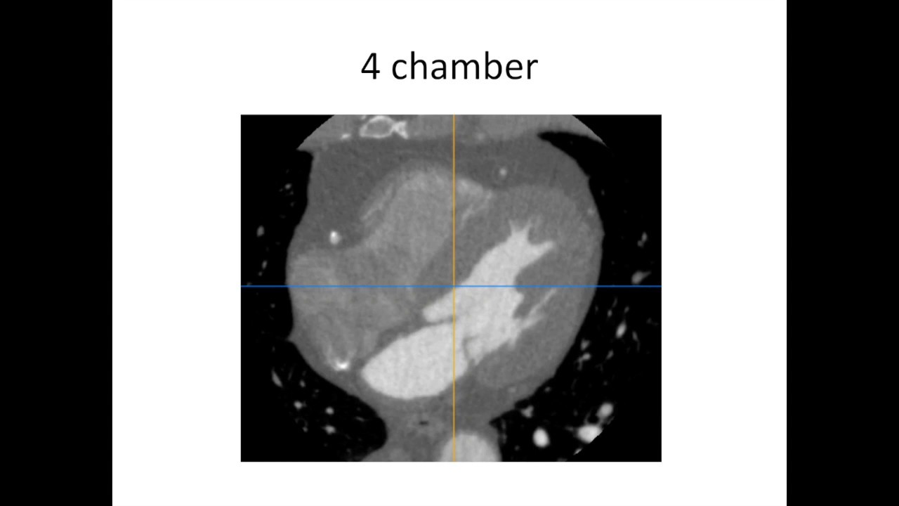 Cardiac anatomy for radiology - part 6 - standard views