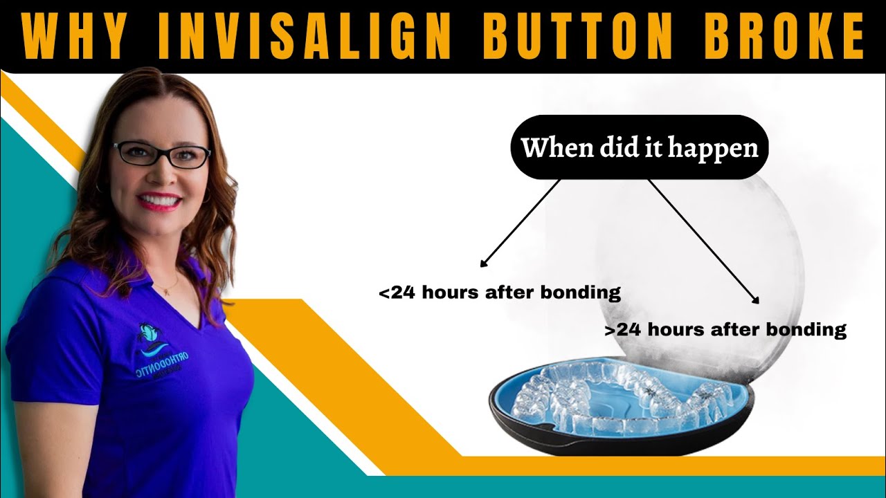 Почему сломалась кнопка или крепление Invisalign? Точные разрезы, фиксация, класс 2, класс 3