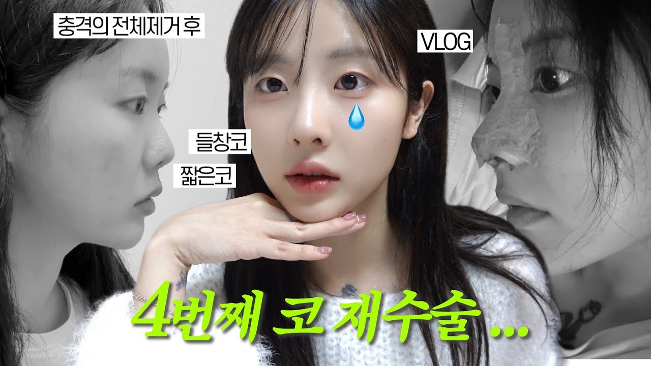 VLOG•무려 네번째 코수술(+귀족수술)브이로그•내가 사라졌던 이유🌧️