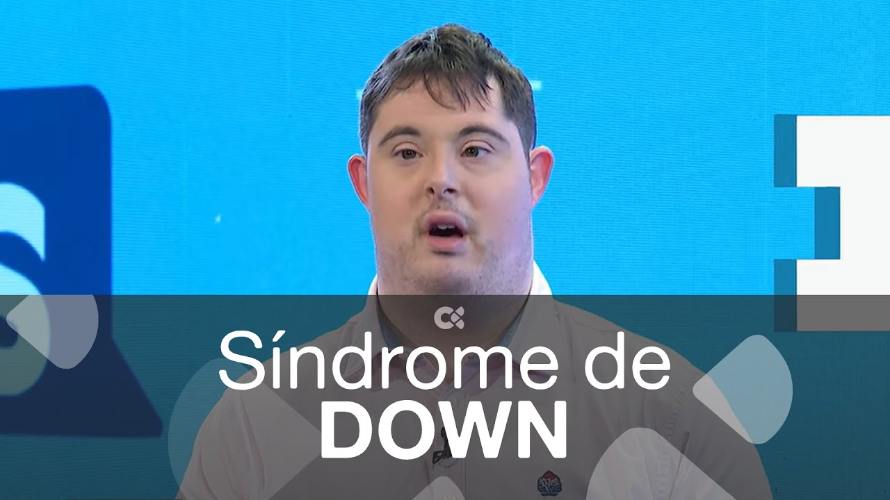 Así somos | Síndrome de down