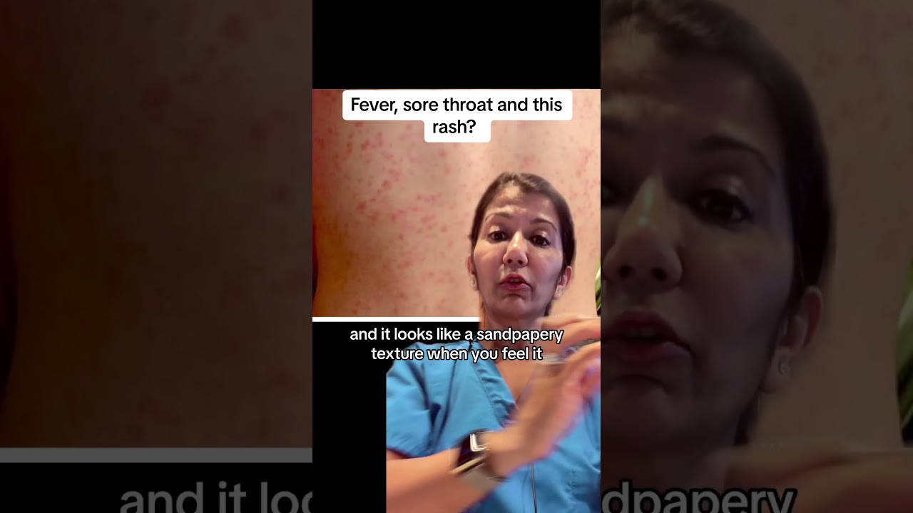 Fever , sore throat rash? Scarlet fever 