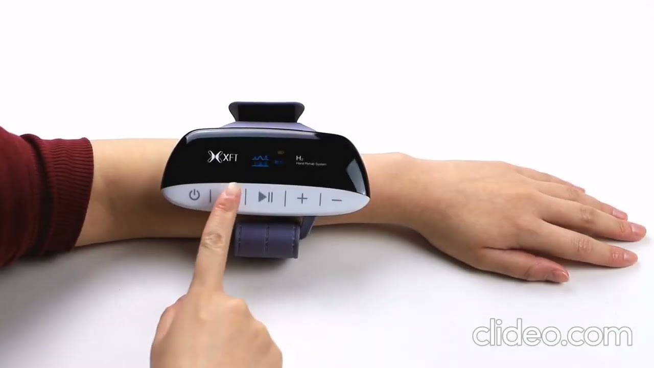 Реабилитация движения руки (кисти) с помощью ФЭС (OmniHi5)