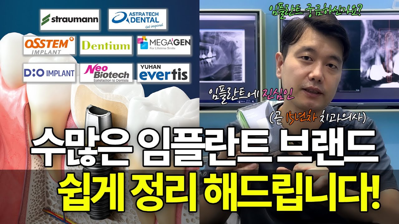 치과의사가 직접 쓰는 임플란트 브랜드 공개 | 스트라우만·오스템·덴티움·디오 완벽 분석 #오늘하루치과 #네비게이션임플란트