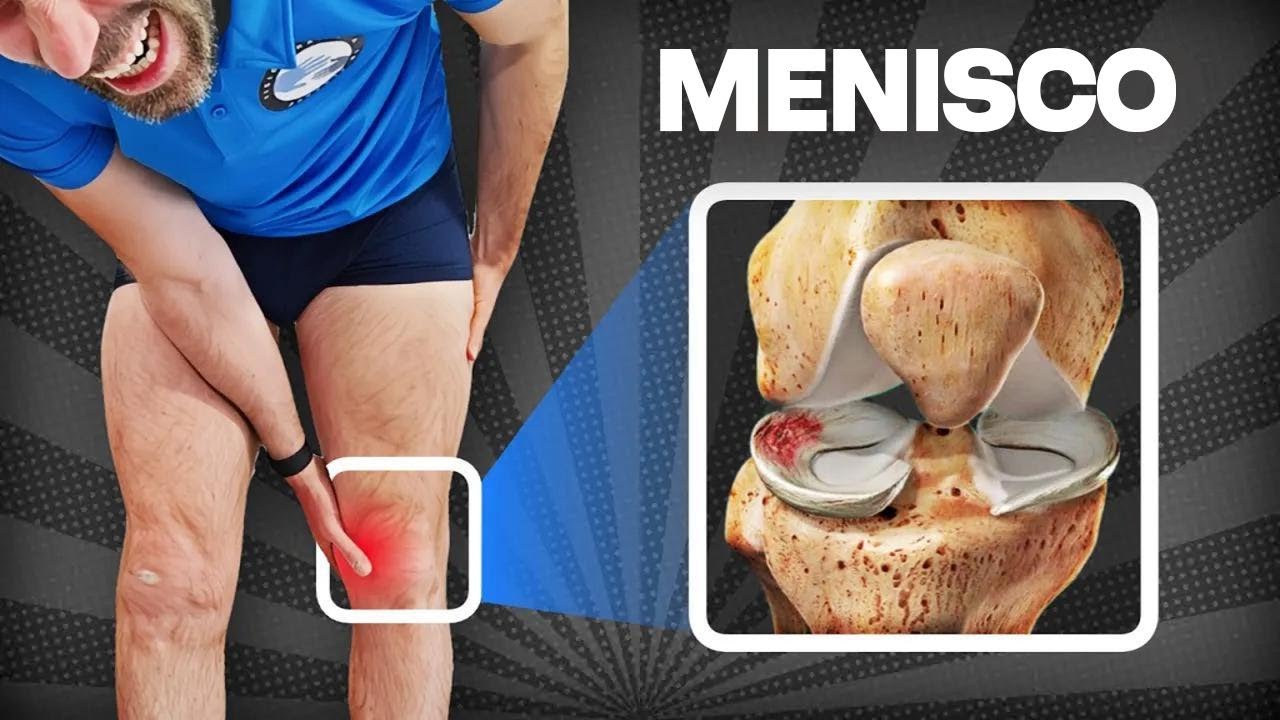 Top 5 exercícios para se recuperar de lesão no menisco