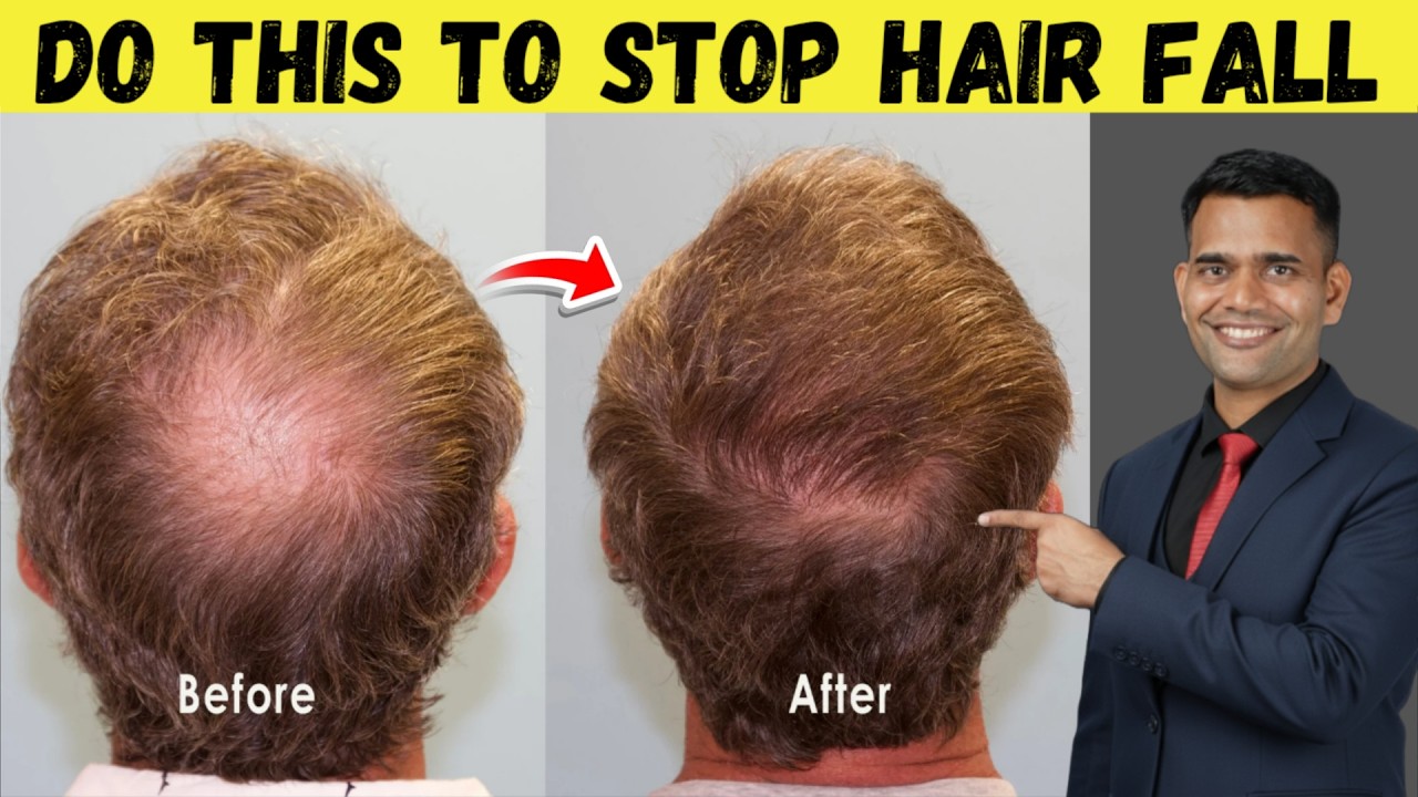 Stop Hair Fall Fast! 5 Things That Actually Work - Dr. Vivek Joshi 