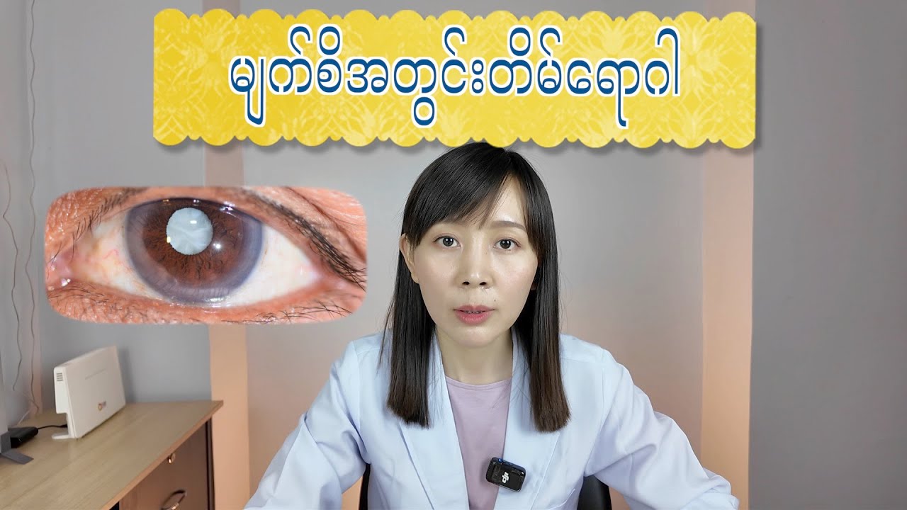 မျက်စိအတွင်းတိမ်ရောဂါအကြောင်းသိကောင်းစရာများ | cataract