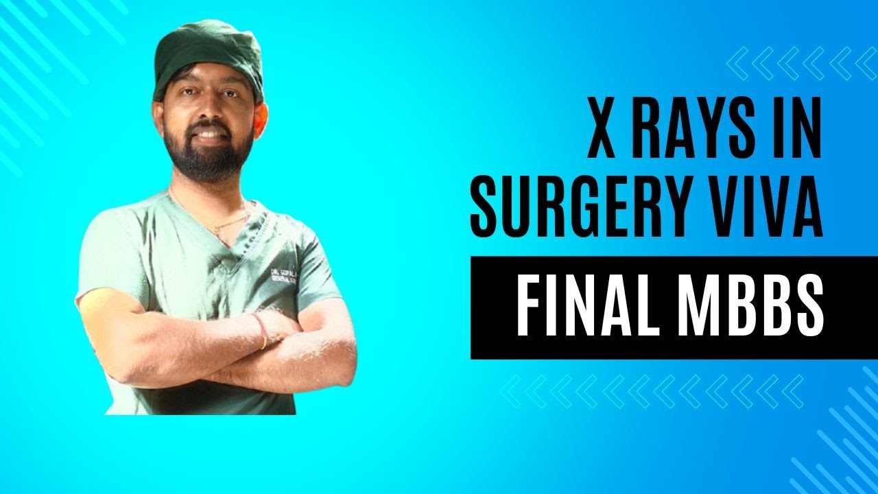 X RAYS IN SURGERY PRACTICAL EXAM FOR FINAL MBBS STUDENTS