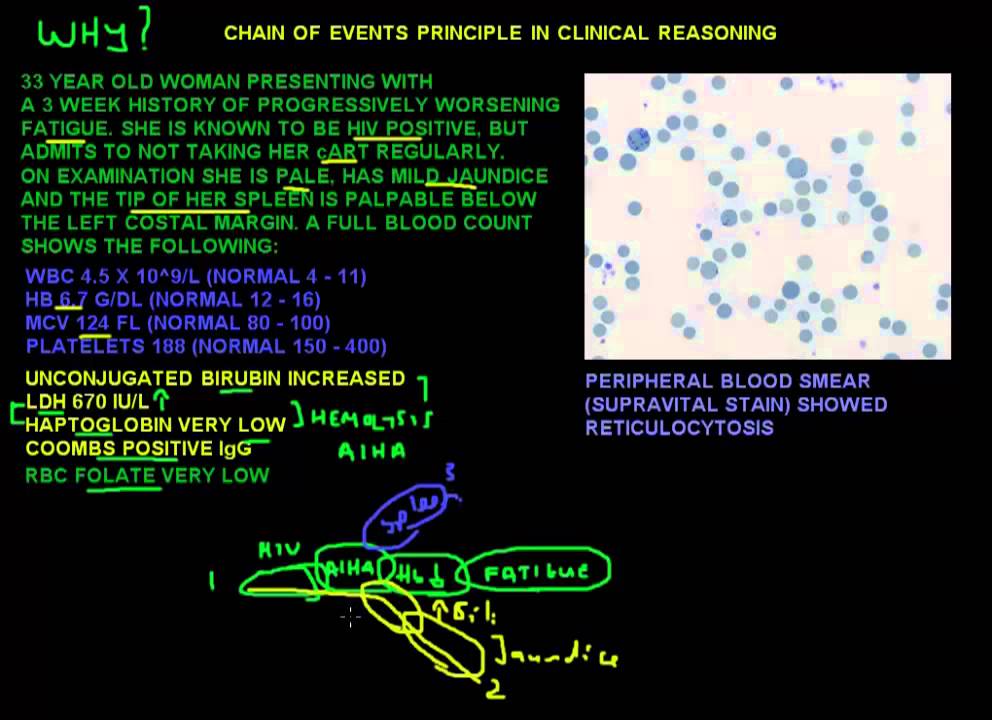Chain of events principle in clinical reasoning for medical students and doctors.