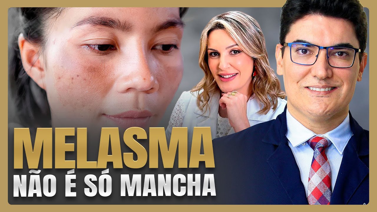 MELASMA NÃO É SÓ MANCHA | Entenda essa Condição Inflamatória e as Novos Tratamentos!