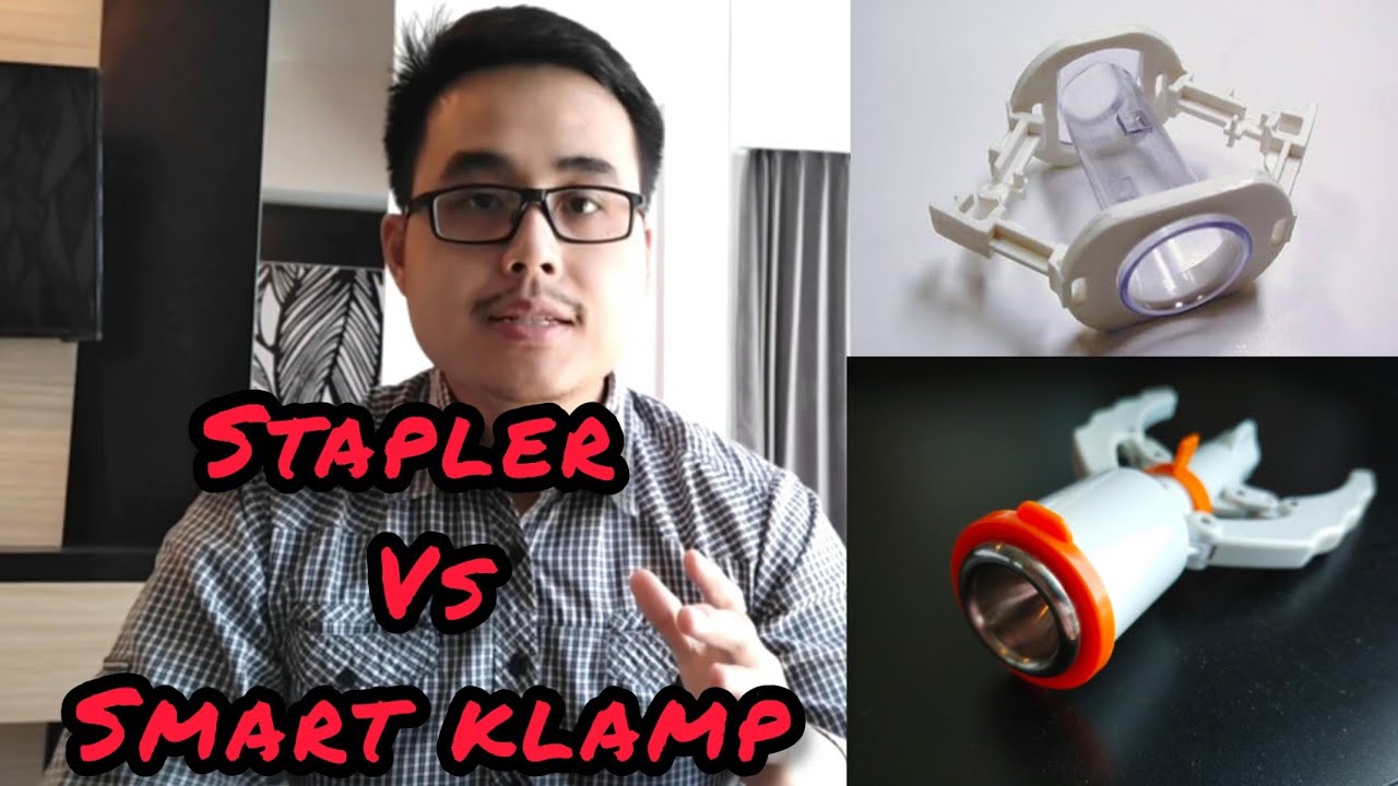 SUNAT ANAK / DEWASA METODE STAPLER ATAU SMART KLAMP YANG LEBIH BAGUS