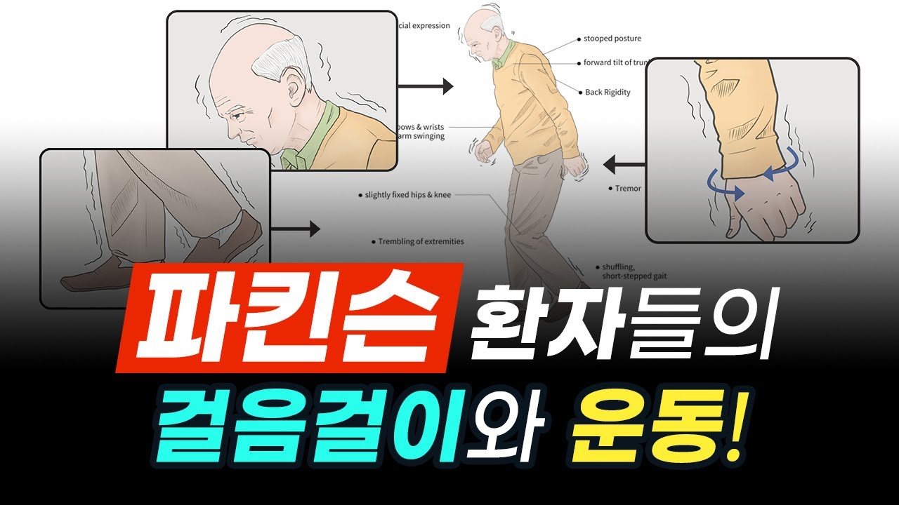 파킨슨병, 바로 알기! -환자들의 걸음걸이와 운동편-