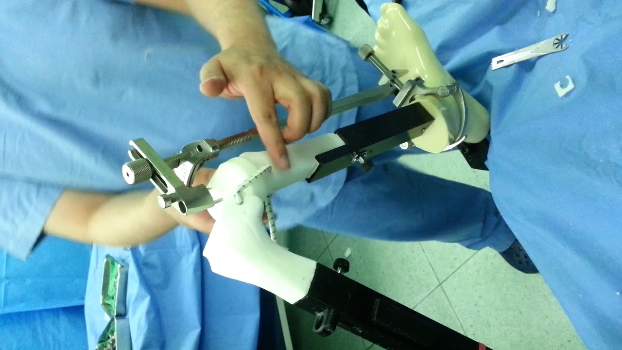 ZIMMER Total knee cutting