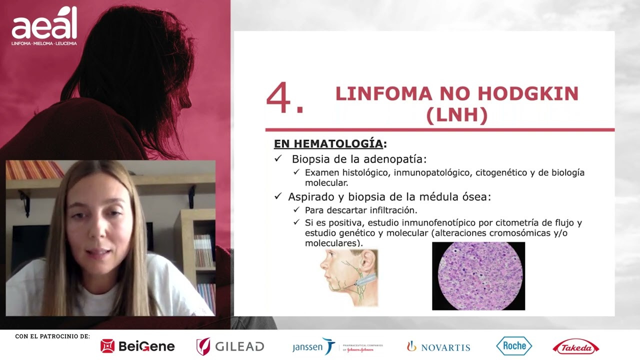 Diagnóstico del linfoma: la importancia de la Atención Primaria