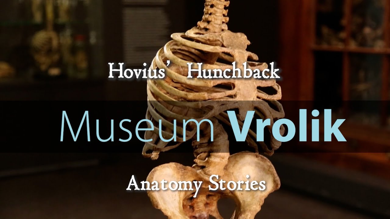 Museum Vrolik - Anatomy Stories 2: Hovius' Hunchback