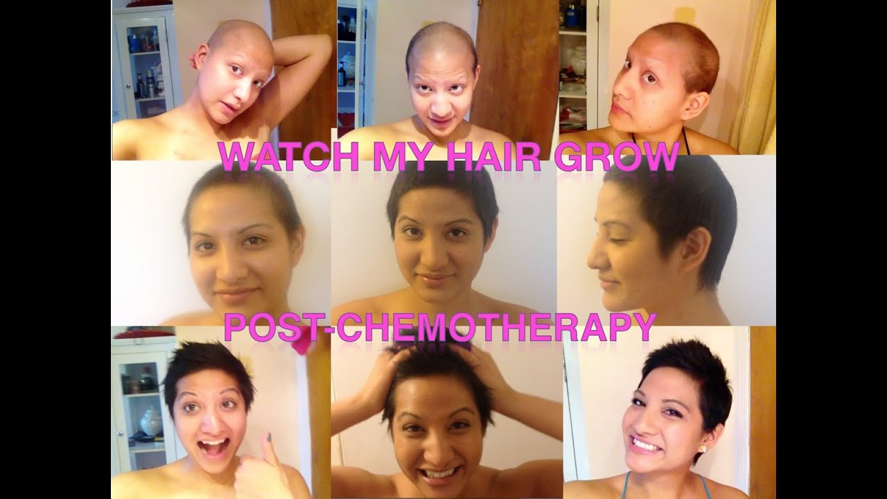 Hairgrowth Post-Chemotherapy | Young women with Breast Cancer
