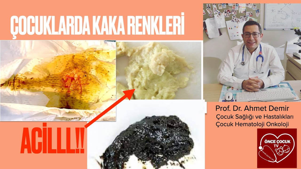 Çocuklarda Kaka Rengi acil bir belirti olabilir ! Prof Dr Ahmet Demir