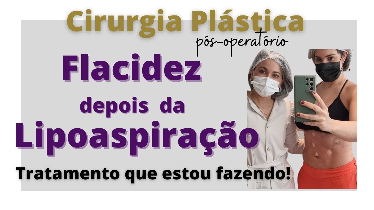 Flacidez de pele após a Lipoaspiração: veja o tratamento que estou fazendo!