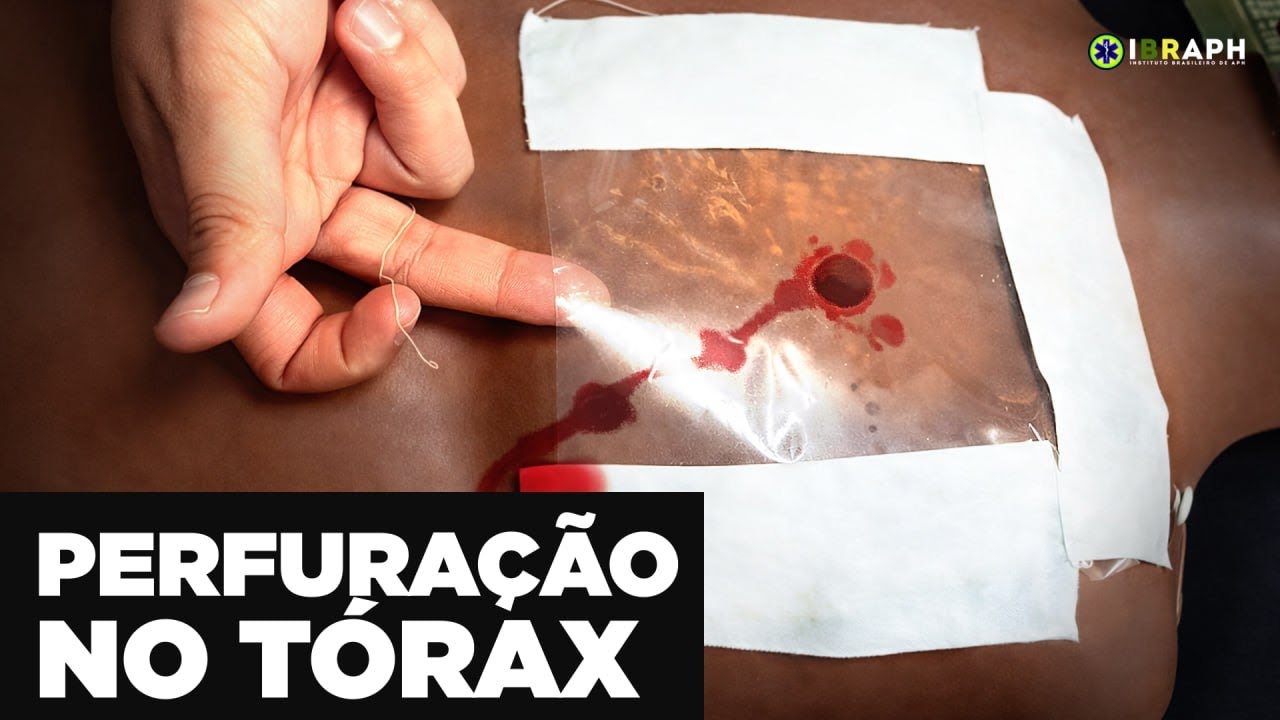 Como fazer Curativo de 3 Pontas (Selo de Tórax Improvisado) no APH