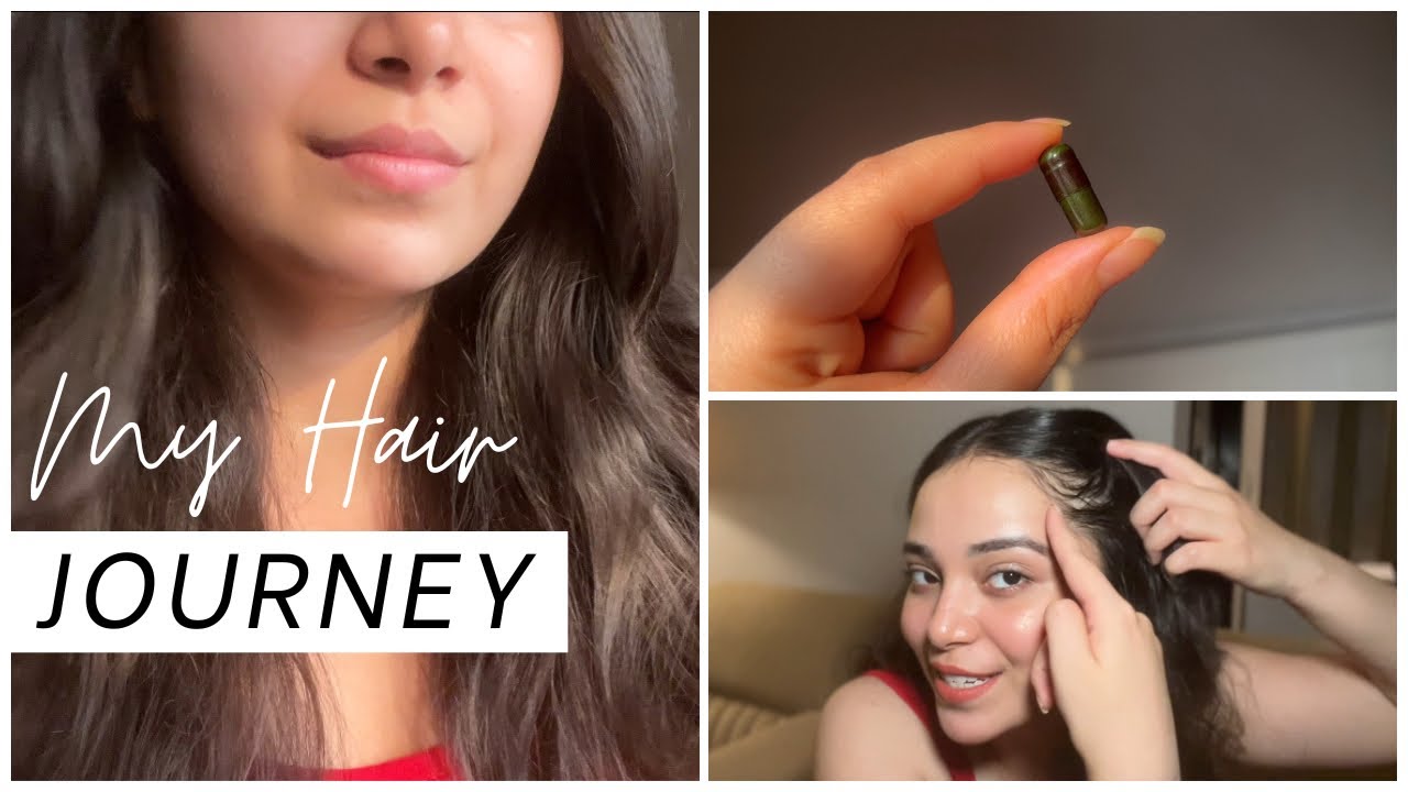 Traya Hair Review: Fake Hype or Real Results? My Honest Journey