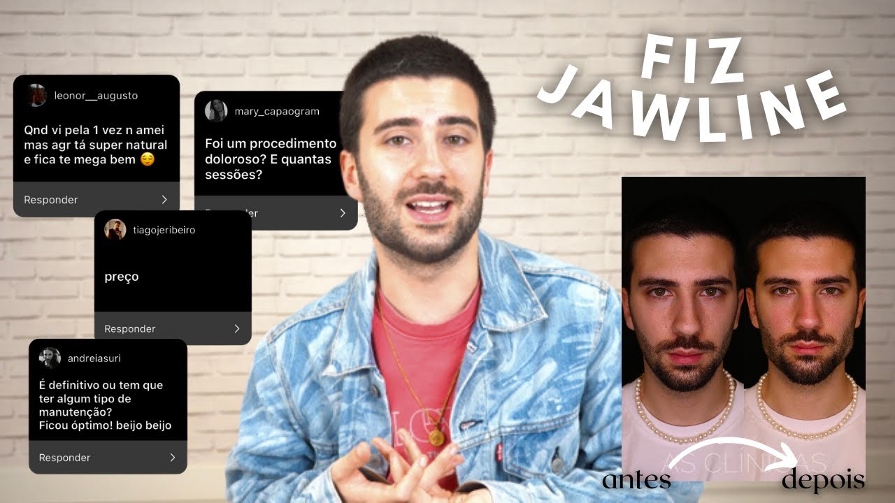 FIZ JAWLINE | JOÃO JONAS