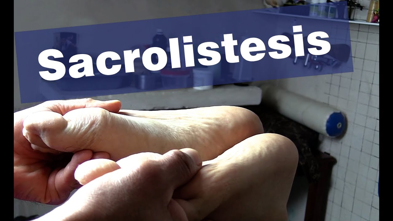 Sacrolistesis |  Lumbopatía I