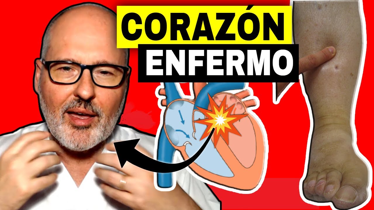 S&Iacute;NTOMAS PELIGROSOS de CORAZON ENFERMO (Detecci&oacute;n y Soluciones)