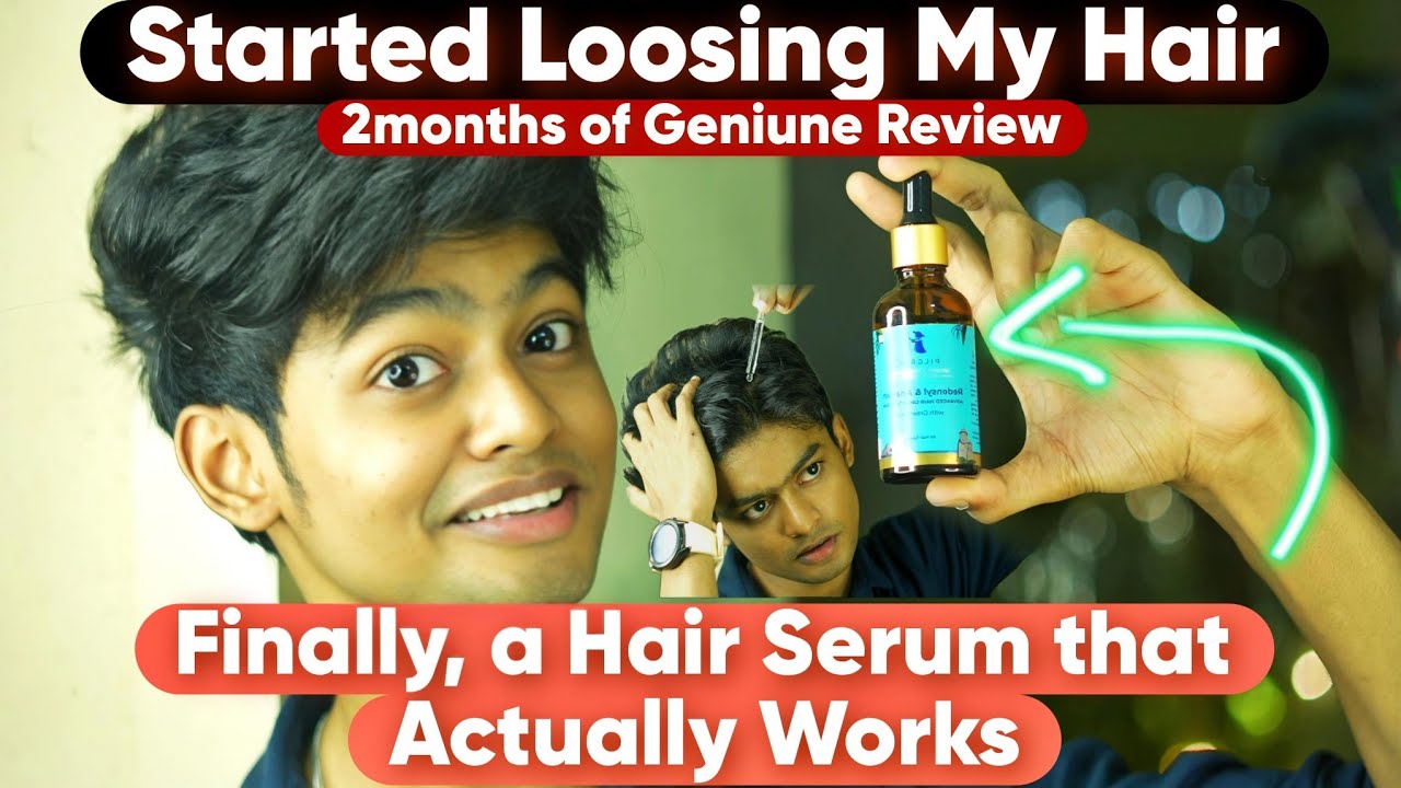 This Hair Serum SIDE EFFECTS🤯 | NOT A PROMOTION | 2Months Of Real Review 💯| SachinJAS Talks