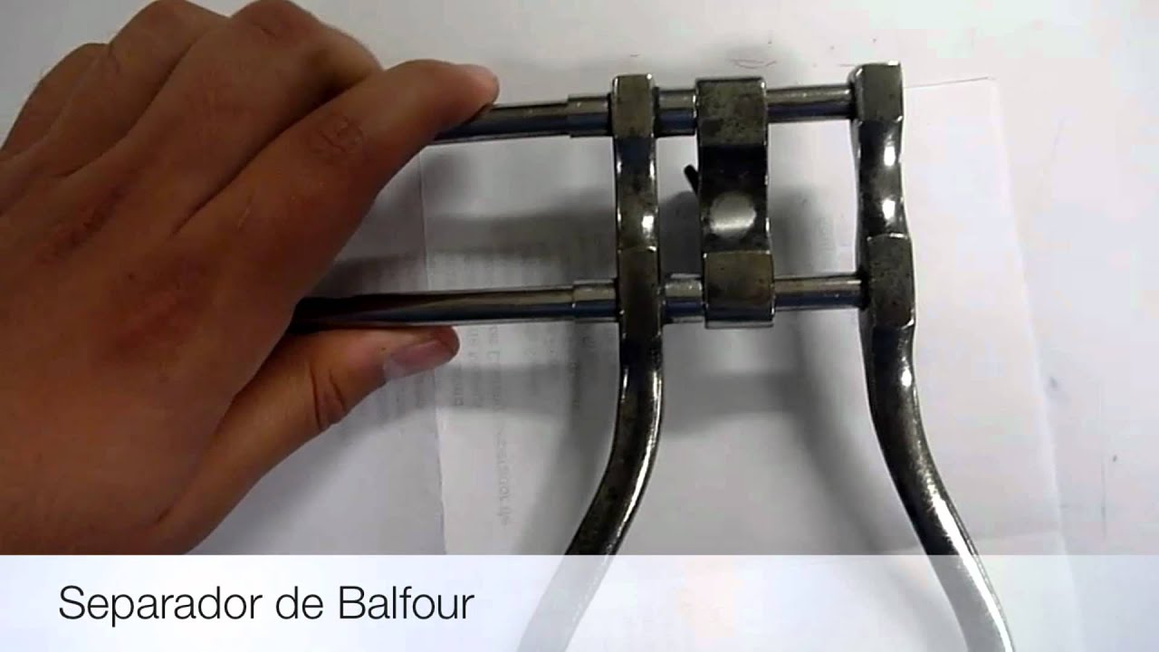 Separador de Balfour
