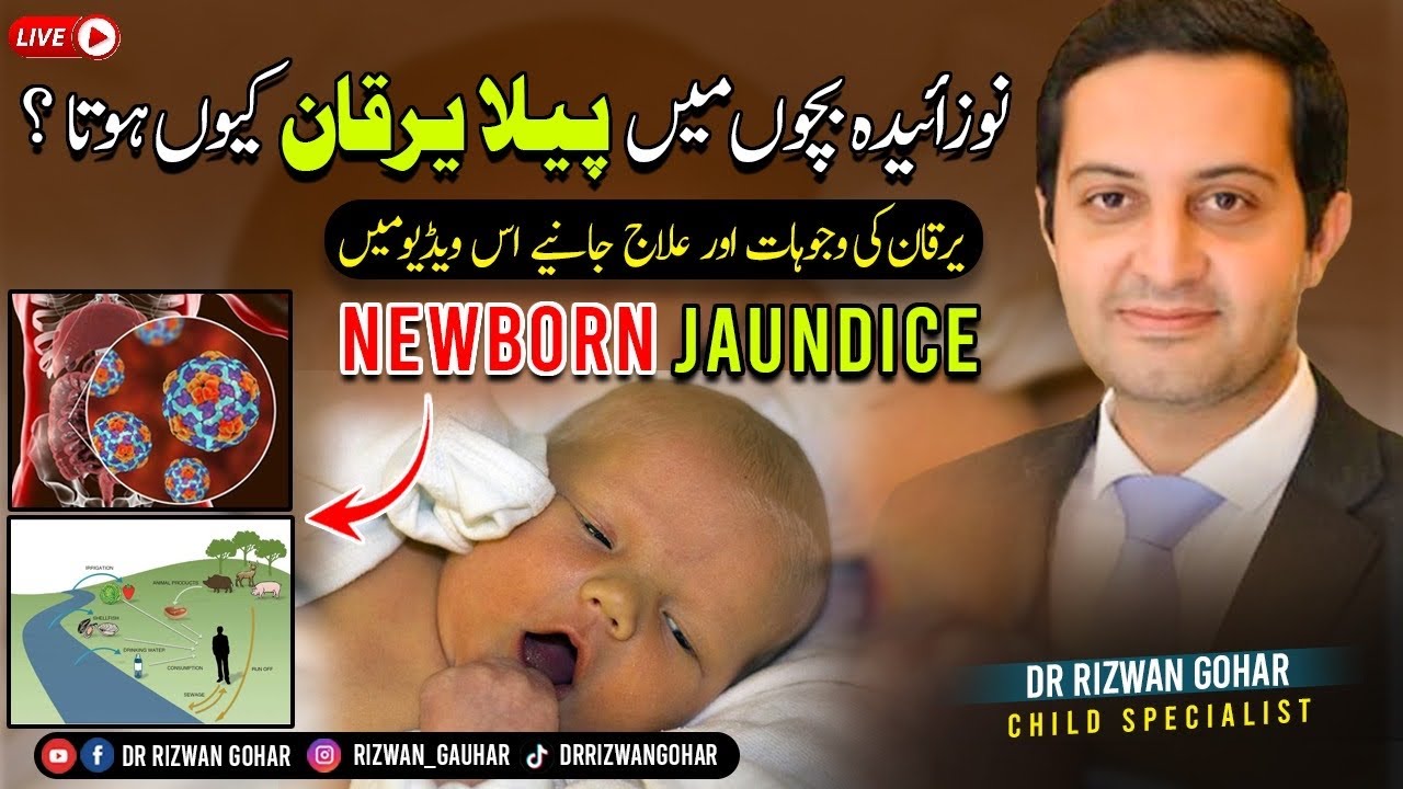How to Save Your Baby from Jaundice🌝👶: Treatment and Causes #jaundice #babies #treatment #jnn