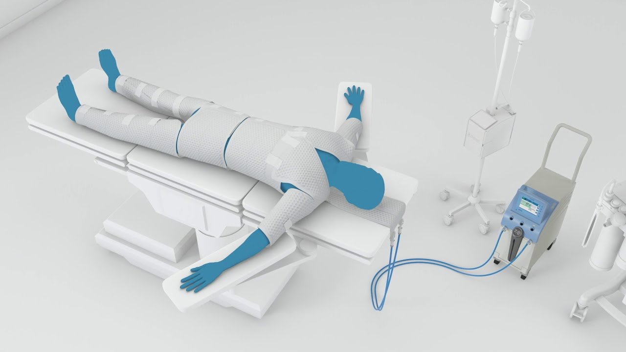 2. Allon® Key Benefits: Designed With Your Patients In Mind