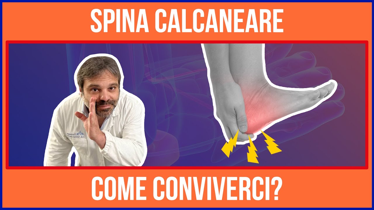 💣 COME CONVIVERE con la SPINA CALCANEARE : I MIGLIORI CONSIGLI