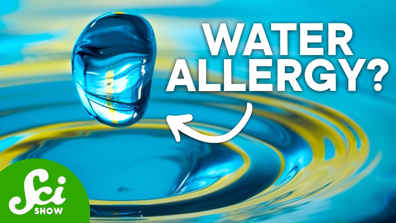 The 7 Weirdest Recorded Allergies